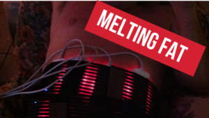 Melting fat with Low Level laser